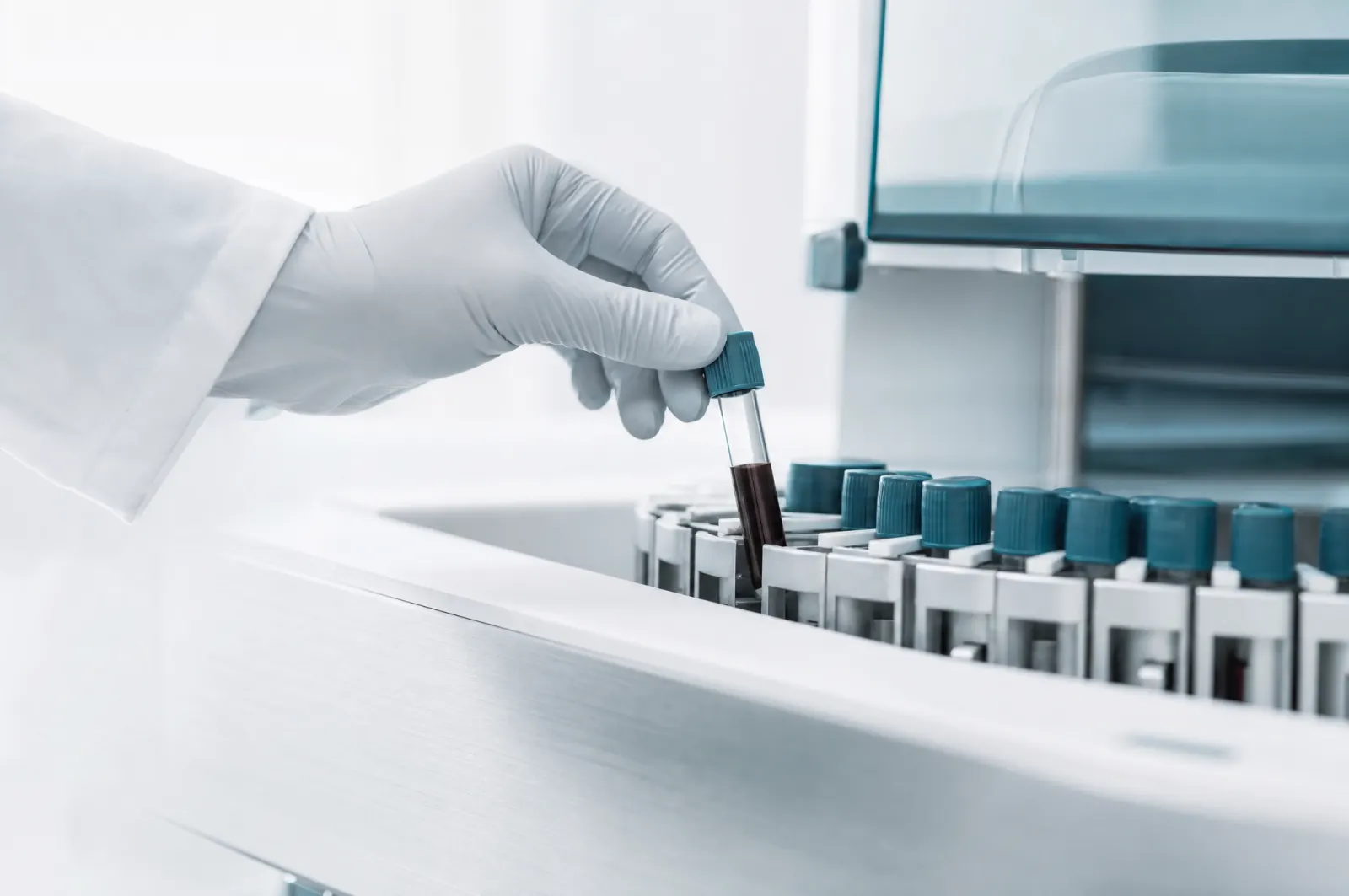 Behandschuhte Hand setzt ein Probenröhrchen in einen Laboranalysator ein